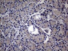 MAK Antibody - Immunohistochemical staining of paraffin-embedded Human pancreas tissue within the normal limits using anti-MAK mouse monoclonal antibody. (Heat-induced epitope retrieval by 1mM EDTA in 10mM Tris buffer. (pH8.5) at 120°C for 3 min. (1:150)