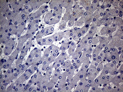 MAK Antibody - Immunohistochemical staining of paraffin-embedded Human liver tissue within the normal limits using anti-MAK mouse monoclonal antibody.This figure shows negative staining. (Heat-induced epitope retrieval by 1mM EDTA in 10mM Tris buffer. (pH8.5) at 120°C for 3 min. (1:150)