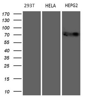 MAK Antibody - Western blot analysis of extracts. (35ug) from 3 different cell lines by using anti-MAK monoclonal antibody. (HepG2: human; HeLa: human; 293T:human). (1:500)