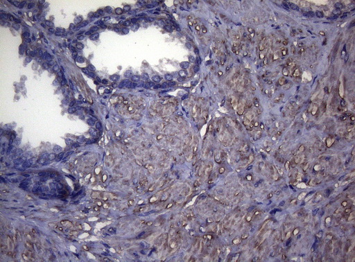 MAK Antibody - Immunohistochemical staining of paraffin-embedded Human prostate tissue within the normal limits using anti-MAK mouse monoclonal antibody. (Heat-induced epitope retrieval by 1mM EDTA in 10mM Tris buffer. (pH8.5) at 120°C for 3 min. (1:150)