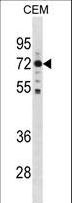 MAK Antibody - MAK Antibody western blot of CEM cell line lysates (35 ug/lane). The MAK antibody detected the MAK protein (arrow).