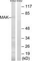MAK Antibody - Western blot analysis of extracts from K562 cells, using MAK (Ab-159) antibody.