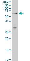 MAK Antibody - MAK monoclonal antibody (M01), clone 3E5. Western Blot analysis of MAK expression in Raw 264.7.