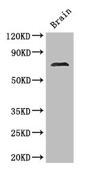 MAK Antibody - Positive WB detected in:Mouse brain tissue;All lanes: MAK antibody at 2.8ug/ml;Secondary;Goat polyclonal to rabbit IgG at 1/50000 dilution;Predicted band size: 71,74,67 kDa;Observed band size: 71 kDa;