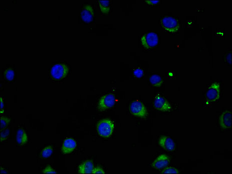 MAK Antibody - Immunofluorescent analysis of A549 cells using MAK Antibody at a dilution of 1:100 and Alexa Fluor 488-congugated AffiniPure Goat Anti-Rabbit IgG(H+L)