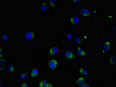 MAK Antibody - Immunofluorescent analysis of A549 cells using MAK Antibody at dilution of 1:100 and Alexa Fluor 488-congugated AffiniPure Goat Anti-Rabbit IgG(H+L)