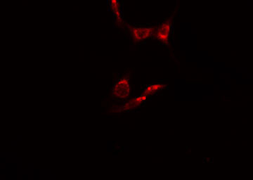 MAK Antibody - Staining HepG2 cells by IF/ICC. The samples were fixed with PFA and permeabilized in 0.1% Triton X-100, then blocked in 10% serum for 45 min at 25°C. The primary antibody was diluted at 1:200 and incubated with the sample for 1 hour at 37°C. An Alexa Fluor 594 conjugated goat anti-rabbit IgG (H+L) antibody, diluted at 1/600, was used as secondary antibody.