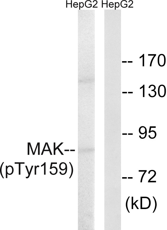 MAK Antibody - Western blot analysis of lysates from HepG2 cells treated with PMA 125ng/ml 30', using MAK (Phospho-Tyr159) Antibody. The lane on the right is blocked with the phospho peptide.