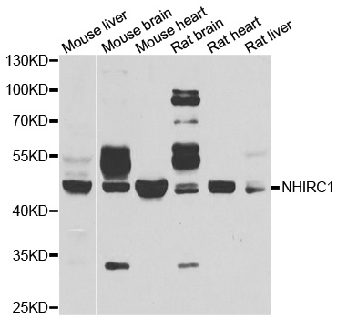 MALIN / NHLRC1 Antibody - Western blot analysis of extracts of various cell lines.