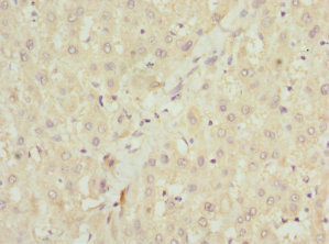 MALIN / NHLRC1 Antibody - Immunohistochemistry of paraffin-embedded human liver tissue at dilution 1:100