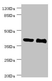 MALIN / NHLRC1 Antibody - Western blot All Lanes:NHLRC1 antibody at 3.13ug/ml Lane 1:LO2 whole cell lysate Lane 2:rat liver tissue Secondary Goat polyclonal to rabbit at 1/10000 dilution Predicted band size: 42kDa Observed band size: 42kDa