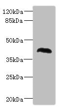 MALIN / NHLRC1 Antibody - Western blot All Lanes:NHLRC1 antibody at 1.37ug/ml+Rat skeletal muscle tissuetissue Secondary Goat polyclonal to rabbit at 1/10000 dilution Predicted band size: 42kDa Observed band size: 42kDa