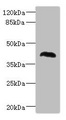 MALIN / NHLRC1 Antibody - Western blot All Lanes:NHLRC1 antibody at 1.37ug/ml+Rat skeletal muscle tissuetissue Secondary Goat polyclonal to rabbit at 1/10000 dilution Predicted band size: 42kDa Observed band size: 42kDa