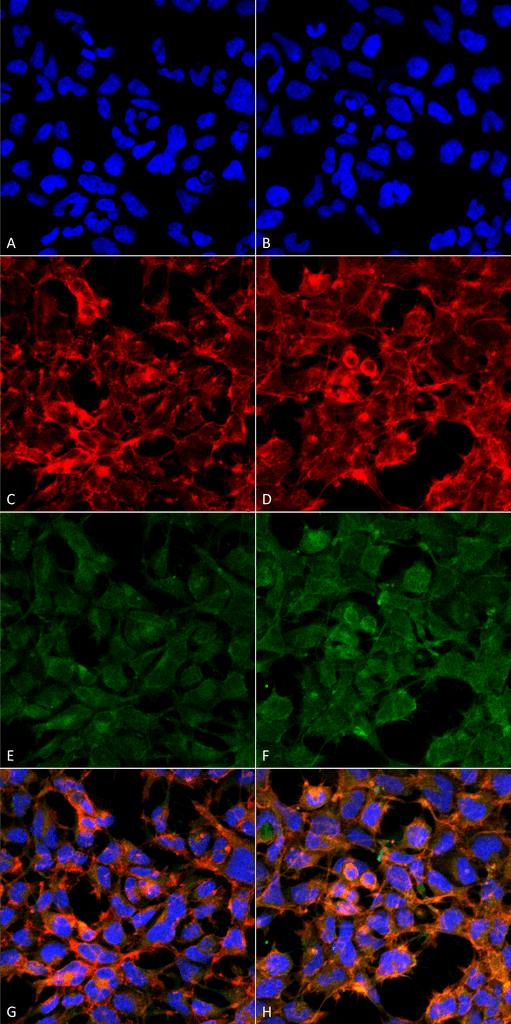 Malondialdehyde Antibody - Immunocytochemistry/Immunofluorescence analysis using Mouse Anti-Malondialdehyde Monoclonal Antibody, Clone 11E3. Tissue: Embryonic kidney epithelial cell line (HEK293). Species: Human. Fixation: 5% Formaldehyde for 5 min. Primary Antibody: Mouse Anti-Malondialdehyde Monoclonal Antibody  at 1:50 for 30-60 min at RT. Secondary Antibody: Goat Anti-Mouse Alexa Fluor 488 at 1:1500 for 30-60 min at RT. Counterstain: Phalloidin Alexa Fluor 633 F-Actin stain; DAPI (blue) nuclear stain at 1:250, 1:50000 for 30-60 min at RT. Magnification: 20X (2X Zoom). (A,C,E,G) - Untreated. (B,D,F,H) - Cells cultured overnight with 50 µM H2O2. (A,B) DAPI (blue) nuclear stain. (C,D) Phalloidin Alexa Fluor 633 F-Actin stain. (E,F) Malondialdehyde Antibody. (G,H) Composite. Courtesy of: Dr. Robert Burke, University of Victoria.