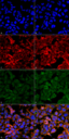 Malondialdehyde Antibody - Immunocytochemistry/Immunofluorescence analysis using Mouse Anti-Malondialdehyde Monoclonal Antibody, Clone 11E3. Tissue: Embryonic kidney epithelial cell line (HEK293). Species: Human. Fixation: 5% Formaldehyde for 5 min. Primary Antibody: Mouse Anti-Malondialdehyde Monoclonal Antibody  at 1:50 for 30-60 min at RT. Secondary Antibody: Goat Anti-Mouse Alexa Fluor 488 at 1:1500 for 30-60 min at RT. Counterstain: Phalloidin Alexa Fluor 633 F-Actin stain; DAPI (blue) nuclear stain at 1:250, 1:50000 for 30-60 min at RT. Magnification: 20X (2X Zoom). (A,C,E,G) - Untreated. (B,D,F,H) - Cells cultured overnight with 50 µM H2O2. (A,B) DAPI (blue) nuclear stain. (C,D) Phalloidin Alexa Fluor 633 F-Actin stain. (E,F) Malondialdehyde Antibody. (G,H) Composite. Courtesy of: Dr. Robert Burke, University of Victoria.