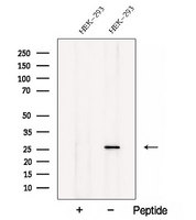 MALSU1 Antibody - Western blot analysis of extracts of HEK293 cells using C7orf30 antibody. The lane on the left was treated with blocking peptide.