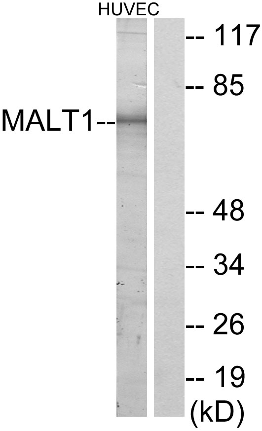 MALT1 Antibody - Western blot analysis of lysates from HUVEC cells, using MALT1 Antibody. The lane on the right is blocked with the synthesized peptide.