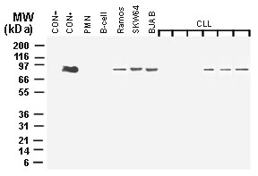 MALT1 Antibody - Western blot of MALT1/Paracaspase expression using Polyclonal Antibody to MALT1/Paracaspase at 1:2000. HEK293N cells transiently transfected with control (empty) plasmid (Ctl-) or human full-length MALT1 (Ctl+) were used as negative or positive controls, respectively. Freshly isolated human polymorphonuclear neutrophils (PMN) and resting B-cells were negative. MALT1 expression was detected in SKW64, Ramos, and BJAB B-cell lymphoma lines, and3 out of 6 B-cell chronic lymphocytic leukemia (CLL) patients.