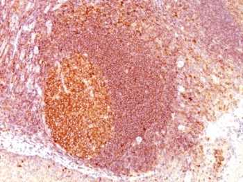 MALT1 Antibody - Formalin-fixed, paraffin-embedded human tonsil stained with MALT1 antibody (SPM578).  This image was taken for the unmodified form of this product. Other forms have not been tested.