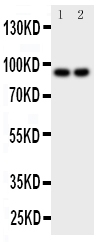 MALT1 Antibody - Anti-MALT1 antibody, Western blotting Lane 1: MCF-7 Cell LysateLane 2: HELA Cell Lysate
