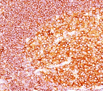 MALT1 Antibody - IHC staining of tonsil tissue with MALT1 antibody (MT1/410).
