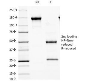 MALT1 Antibody - SDS-PAGE Analysis of Purified, BSA-Free MALT1 Antibody (clone MT1/410). Confirmation of Integrity and Purity of the Antibody.