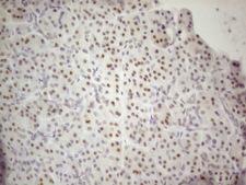 MALT1 Antibody - Immunohistochemical staining of paraffin-embedded Human pancreas tissue using anti-MALT1 mouse monoclonal antibody. (Heat-induced epitope retrieval by 1mM EDTA in 10mM Tris buffer. (pH8.5) at 120°C for 3 min. (1:150)