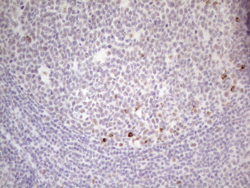 MALT1 Antibody - Immunohistochemical staining of paraffin-embedded Human tonsil using anti-MALT1 mouse monoclonal antibody. (Heat-induced epitope retrieval by 1mM EDTA in 10mM Tris buffer. (pH8.5) at 120°C for 3 min. (1:150)