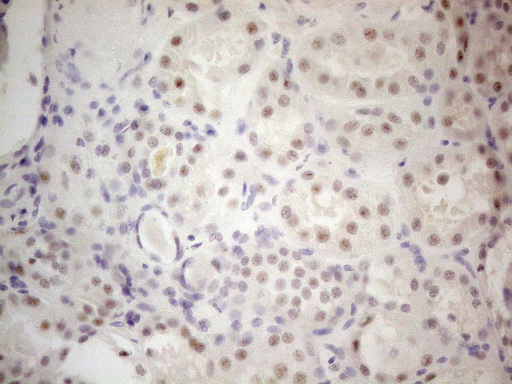 MALT1 Antibody - Immunohistochemical staining of paraffin-embedded Human Kidney tissue using anti-MALT1 mouse monoclonal antibody. (Heat-induced epitope retrieval by 1mM EDTA in 10mM Tris buffer. (pH8.5) at 120°C for 3 min. (1:150)