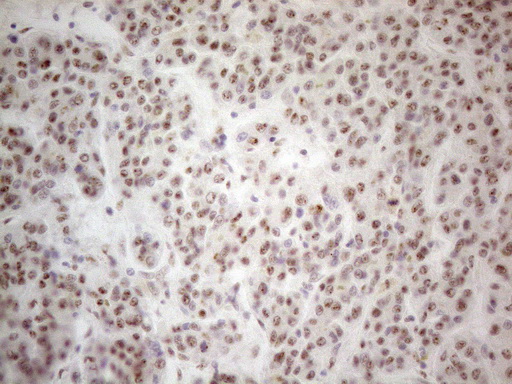 MALT1 Antibody - Immunohistochemical staining of paraffin-embedded Human liver tissue using anti-MALT1 mouse monoclonal antibody. (Heat-induced epitope retrieval by 1mM EDTA in 10mM Tris buffer. (pH8.5) at 120°C for 3 min. (1:150)