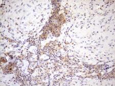 MALT1 Antibody - Immunohistochemical staining of paraffin-embedded Human lymph node tissue within the normal limits using anti-MALT1 mouse monoclonal antibody. (Heat-induced epitope retrieval by 1mM EDTA in 10mM Tris buffer. (pH8.5) at 120°C for 3 min. (1:150)