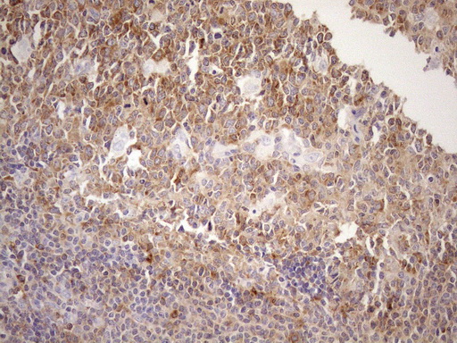 MALT1 Antibody - Immunohistochemical staining of paraffin-embedded Human tonsil within the normal limits using anti-MALT1 mouse monoclonal antibody. (Heat-induced epitope retrieval by 1mM EDTA in 10mM Tris buffer. (pH8.5) at 120°C for 3 min. (1:150)