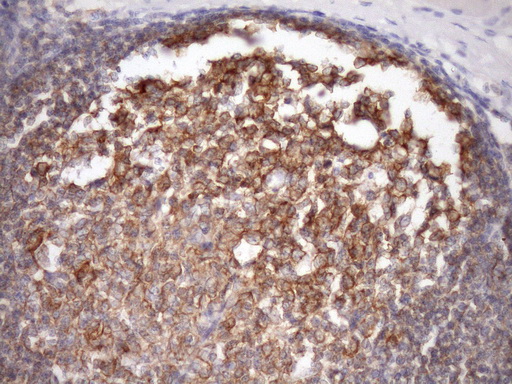 MALT1 Antibody - Immunohistochemical staining of paraffin-embedded Human tonsil within the normal limits using anti-MALT1 mouse monoclonal antibody. (Heat-induced epitope retrieval by Tris-EDTA, pH8.0)(1:150)