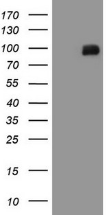 MALT1 Antibody - HEK293T cells were transfected with the pCMV6-ENTRY control (Left lane) or pCMV6-ENTRY MALT1 (Right lane) cDNA for 48 hrs and lysed. Equivalent amounts of cell lysates (5 ug per lane) were separated by SDS-PAGE and immunoblotted with anti-MALT1 (1:2000).