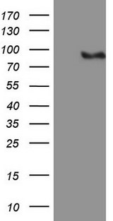 MALT1 Antibody - HEK293T cells were transfected with the pCMV6-ENTRY control (Left lane) or pCMV6-ENTRY MALT1 (Right lane) cDNA for 48 hrs and lysed. Equivalent amounts of cell lysates (5 ug per lane) were separated by SDS-PAGE and immunoblotted with anti-MALT1 (1:500).
