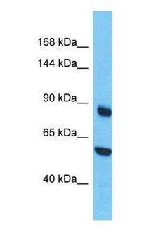 MALT1 Antibody - Western blot of MALT1 Antibody with human A549 Whole Cell lysate.  This image was taken for the unconjugated form of this product. Other forms have not been tested.