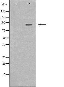 MALT1 Antibody - Western blot analysis of extracts of HeLa cells using MALT1 antibody. The lane on the left is treated with the antigen-specific peptide.