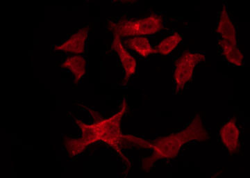 MALT1 Antibody - Staining HuvEc cells by IF/ICC. The samples were fixed with PFA and permeabilized in 0.1% Triton X-100, then blocked in 10% serum for 45 min at 25°C. The primary antibody was diluted at 1:200 and incubated with the sample for 1 hour at 37°C. An Alexa Fluor 594 conjugated goat anti-rabbit IgG (H+L) Ab, diluted at 1/600, was used as the secondary antibody.