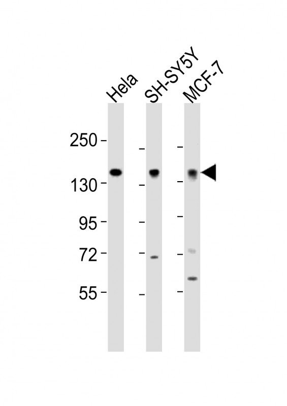 MAML2 Antibody - All lanes : Anti-MAML2 Antibody at 1:2000 dilution Lane 1: HeLa whole cell lysates Lane 2: SH-SY5Y whole cell lysates Lane 3: MCF-7 whole cell lysates Lysates/proteins at 20 ug per lane. Secondary Goat Anti-Rabbit IgG, (H+L), Peroxidase conjugated at 1/10000 dilution Predicted band size : 125 kDa Blocking/Dilution buffer: 5% NFDM/TBST.