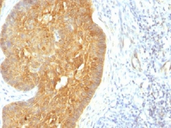 MAML2 Antibody - IHC testing of FFPE human skin with acidic Cytokeratin antibody (clone KRTL/1377). Staining of FFPE tissue requires boiling sections in 10mM citrate buffer, pH6, for 10-20 min followed by cooling at RT for 20 min.