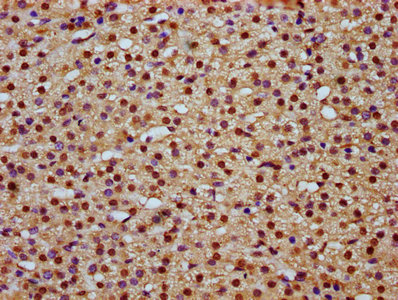 MAML2 Antibody - Immunohistochemistry Dilution at 1:800 and staining in paraffin-embedded human adrenal gland tissue performed on a Leica BondTM system. After dewaxing and hydration, antigen retrieval was mediated by high pressure in a citrate buffer (pH 6.0). Section was blocked with 10% normal Goat serum 30min at RT. Then primary antibody (1% BSA) was incubated at 4°C overnight. The primary is detected by a biotinylated Secondary antibody and visualized using an HRP conjugated SP system.