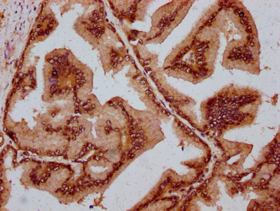 MAML2 Antibody - Immunohistochemistry Dilution at 1:800 and staining in paraffin-embedded human prostate tissue performed on a Leica BondTM system. After dewaxing and hydration, antigen retrieval was mediated by high pressure in a citrate buffer (pH 6.0). Section was blocked with 10% normal Goat serum 30min at RT. Then primary antibody (1% BSA) was incubated at 4°C overnight. The primary is detected by a biotinylated Secondary antibody and visualized using an HRP conjugated SP system.
