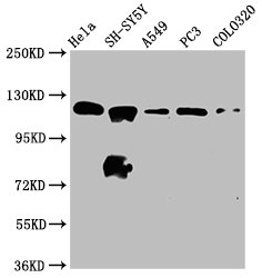 MAML2 Antibody - Western Blot Positive WB detected in: Hela whole cell lysate, SH-SY5Y whole cell lysate, A549 whole cell lysate, PC3 whole cell lysate, COLO320 whole cell lysate All Lanes: MAML2 antibody at 2.2µg/ml Secondary Goat polyclonal to rabbit IgG at 1/50000 dilution Predicted band size: 126 KDa Observed band size: 126 KDa