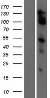 MAML2 Protein - Western validation with an anti-DDK antibody * L: Control HEK293 lysate R: Over-expression lysate