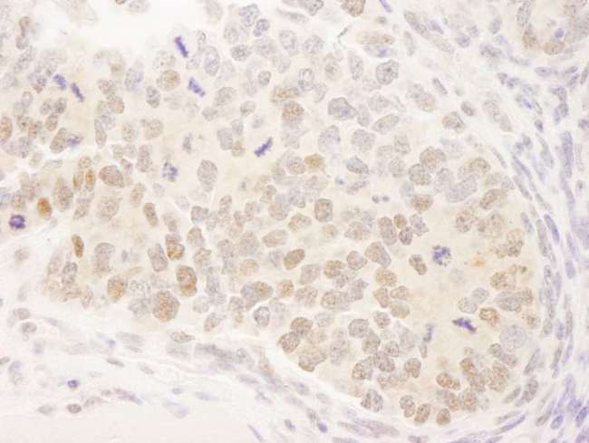 MAML3 / CAGH3 Antibody - Detection of Mouse MAML3 by Immunohistochemistry. Sample: FFPE section of mouse teratoma. Antibody: Affinity purified rabbit anti-MAML3 used at a dilution of 1:100.