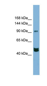 MAML3 / CAGH3 Antibody - MAML3 antibody Western blot of PANC1 cell lysate. This image was taken for the unconjugated form of this product. Other forms have not been tested.