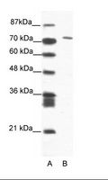 MAMLD1 Antibody - A: Marker, B: Jurkat Cell Lysate.  This image was taken for the unconjugated form of this product. Other forms have not been tested.