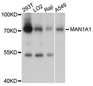MAN1A1 Antibody - Western blot analysis of extracts of various cell lines, using MAN1A1 antibody at 1:1000 dilution. The secondary antibody used was an HRP Goat Anti-Rabbit IgG (H+L) at 1:10000 dilution. Lysates were loaded 25ug per lane and 3% nonfat dry milk in TBST was used for blocking. An ECL Kit was used for detection and the exposure time was 1s.