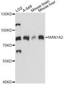 MAN1A2 Antibody - Western blot analysis of extracts of various cell lines, using MAN1A2 antibody at 1:1000 dilution. The secondary antibody used was an HRP Goat Anti-Rabbit IgG (H+L) at 1:10000 dilution. Lysates were loaded 25ug per lane and 3% nonfat dry milk in TBST was used for blocking. An ECL Kit was used for detection and the exposure time was 30s.