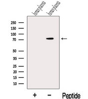 MAN1A2 Antibody - Western blot analysis of extracts of human placenta tissue using MAN1A2 antibody. The lane on the left was treated with blocking peptide.